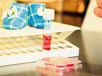 Tüp bebekte katkı payı şoku