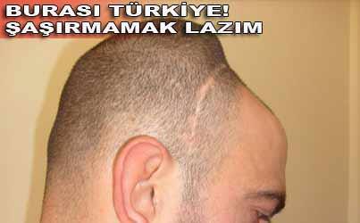 Ona sağlam raporu verdiler!