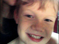 ALD'ye karşı gen mucizesi