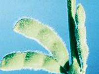 Soya kanserin ilacı