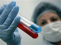 Domuz gribinde sevindirici haber