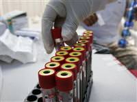 AIDS tedavisinde yeni ışık