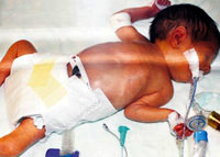 Berrak yeniden doğdu