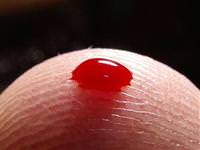 Niçin insanların kanları birbirlerinden farklı?