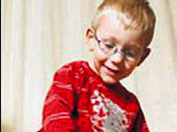 Ördeği taklit edip yürümeyi başardı