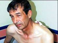 Apartmanda çöp kavgası