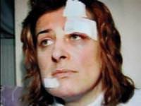 Ölü taklidi yaparak canını kurtardı