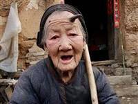 Alnında boynuz çıktı