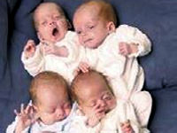 Çoğul gebeliklerde ölüm riski daha çok