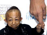 Dünyanın en kısası öldü!