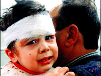 Savaşın acı yüzü