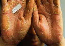 İsrail'in içirdiği suda ne var?