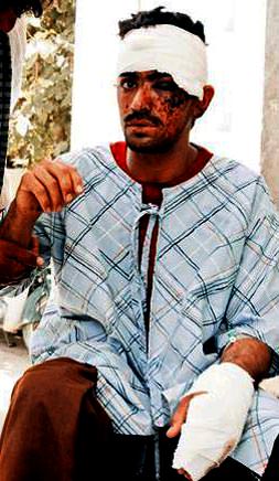 Düğün törenine intihar saldırısı