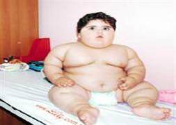 2 yaşında ama 33,5 kilo