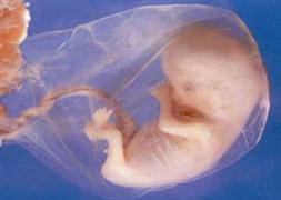 Doğmamış bebek annesini kurtardı