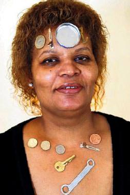 Aşırı stres hayatını zindan etti