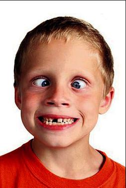 Şaşı çocuklar yalnız kalıyor