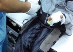 Küçük bir maytap gözünden etti!