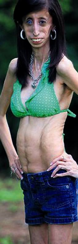 Günde 60 kez yiyor ama 25 kiloda...