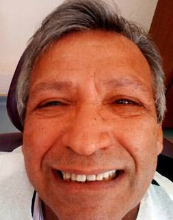 ’Ölmek isteseydi diş yaptırmazdı’