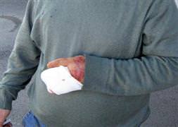 Acemi kasaplar acil serviste