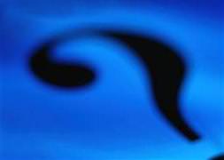 Öksürük şurubu mu öldürdü?