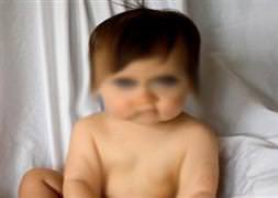 Mumla oynarken yandı