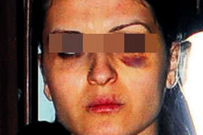 Yatak odası baskını