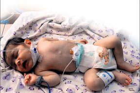 Ölüm teğet geçti