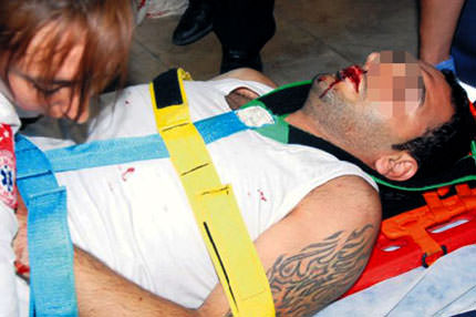 İnsanlığa bıçak