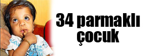 34 parmaklı çocuk