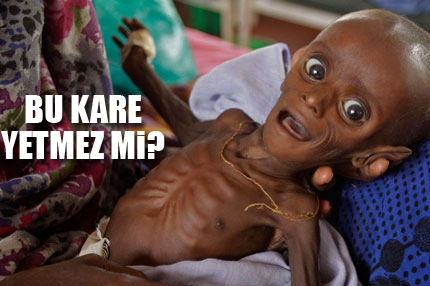 Somali’den yürek burkan kareler