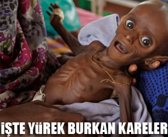 Somali'den yürek burkan kareler