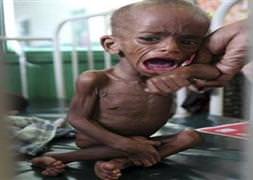 Somali'ye 441 milyon TL