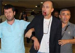 'Kahrolsun PKK' dedi dayağı yedi