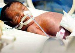 O bebek de terör kurbanı