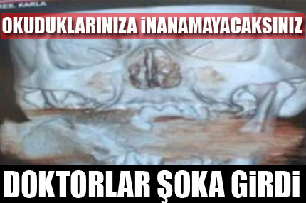 Okuduklarınıza inanmakta zorlanacaksınız