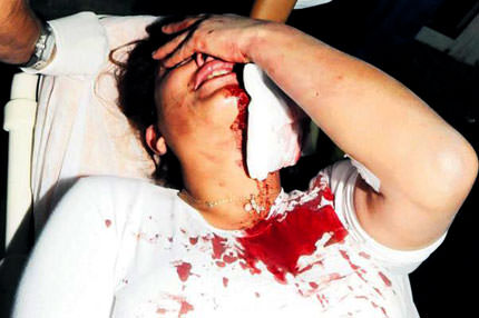 Güzelliğe falçata attı