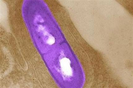 ABD’de listeria salgını: 21 ölü