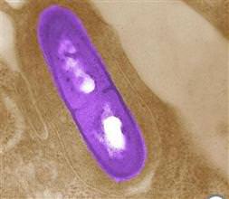 ABD’de listeria salgını: 21 ölü