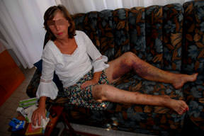 Alman kadına müzik dayağı