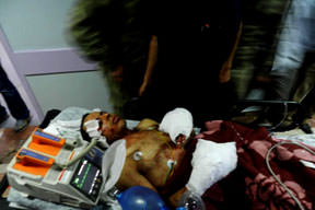 Hainlik elinde patladı