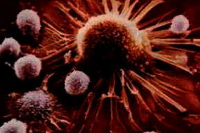 Hastalık geni bulundu