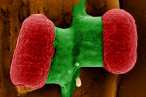 EHEC kabusu geri mi döndü?