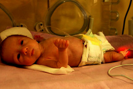 Zayıf doğmak zekayı vuruyor