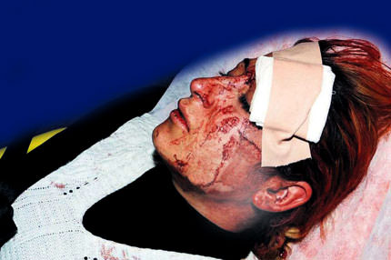 Eski eş yine kan akıttı