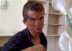 İşte tarihe geçecek ameliyat