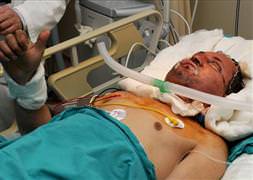 Yüz ve kol nakilleriyle başlayan tartışma