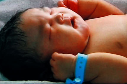 Gözlerini 7 kilo açtı