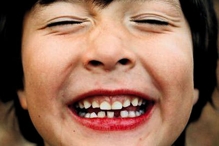 Süt dişleri dökülmesin